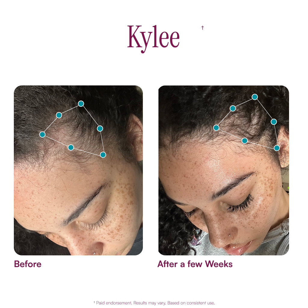 MyBiotin® Growth+™