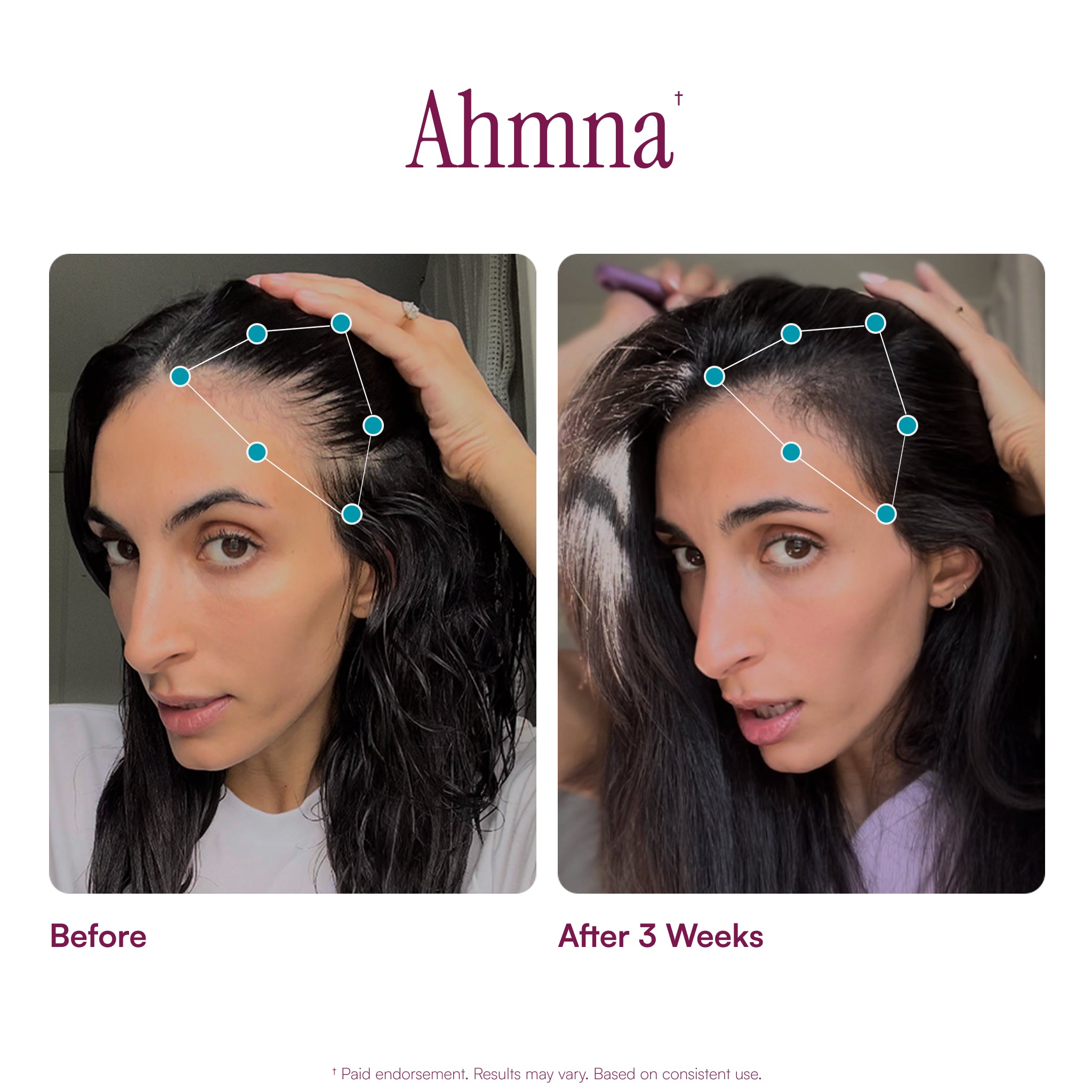 MyBiotin® ProClinical | Gummies