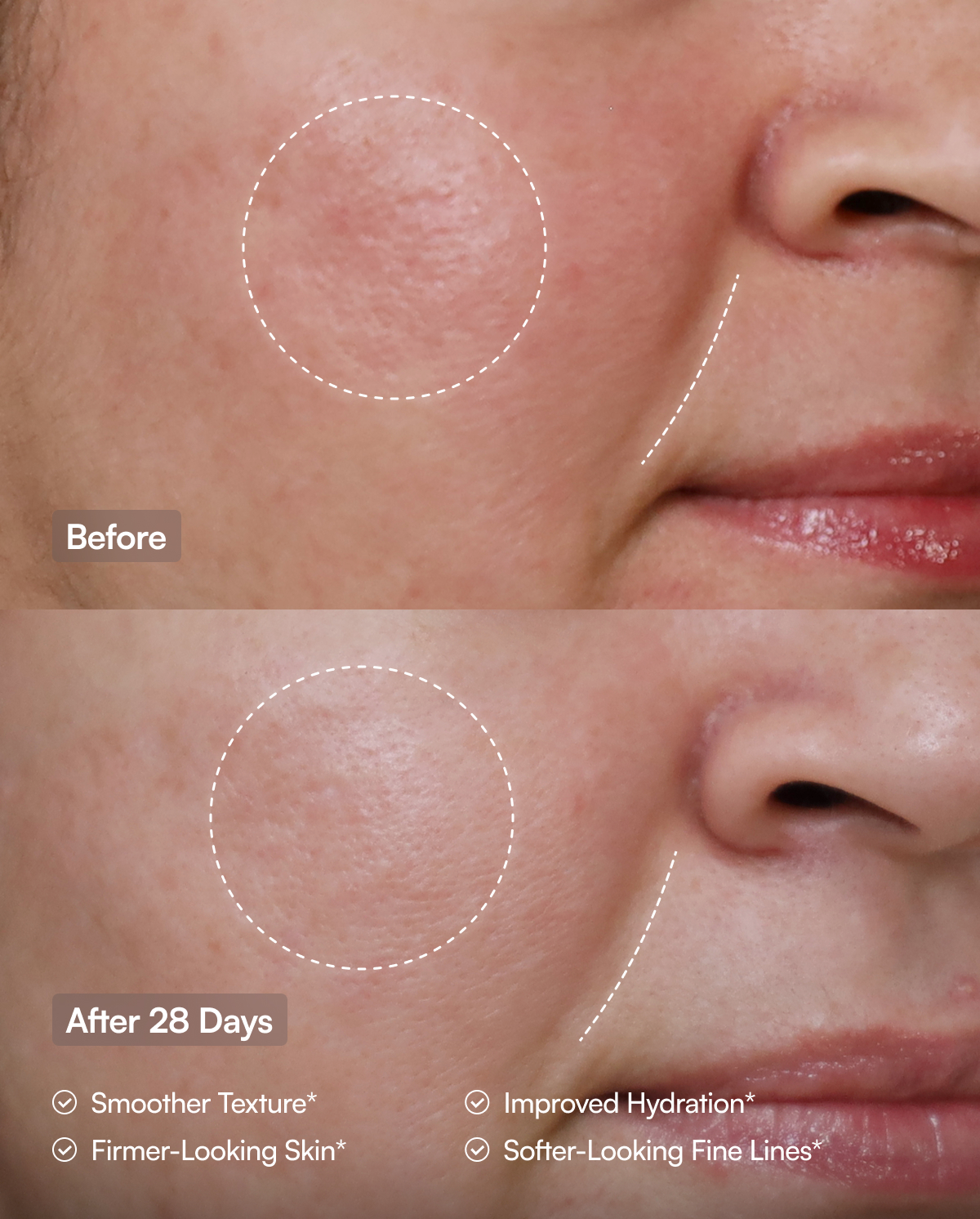 Before-and-after comparison of a person's facial skin texture, with text indicating improvements after 28 days of using Purity Products Derma5D.