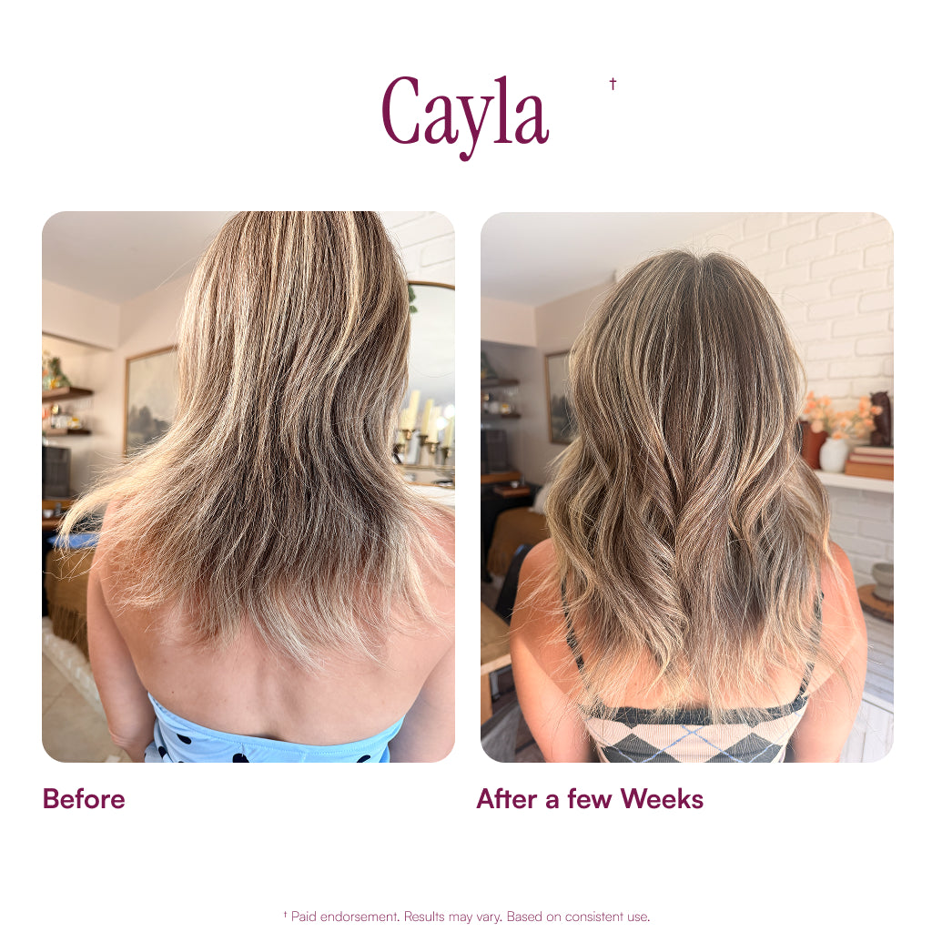 MyBiotin® Growth+™