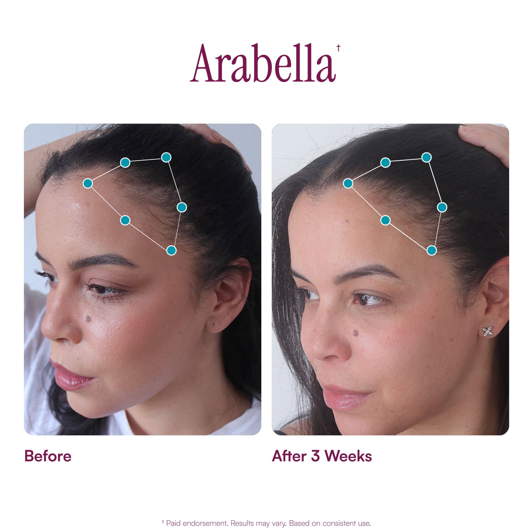 MyBiotin™ ProClinical | Capsules