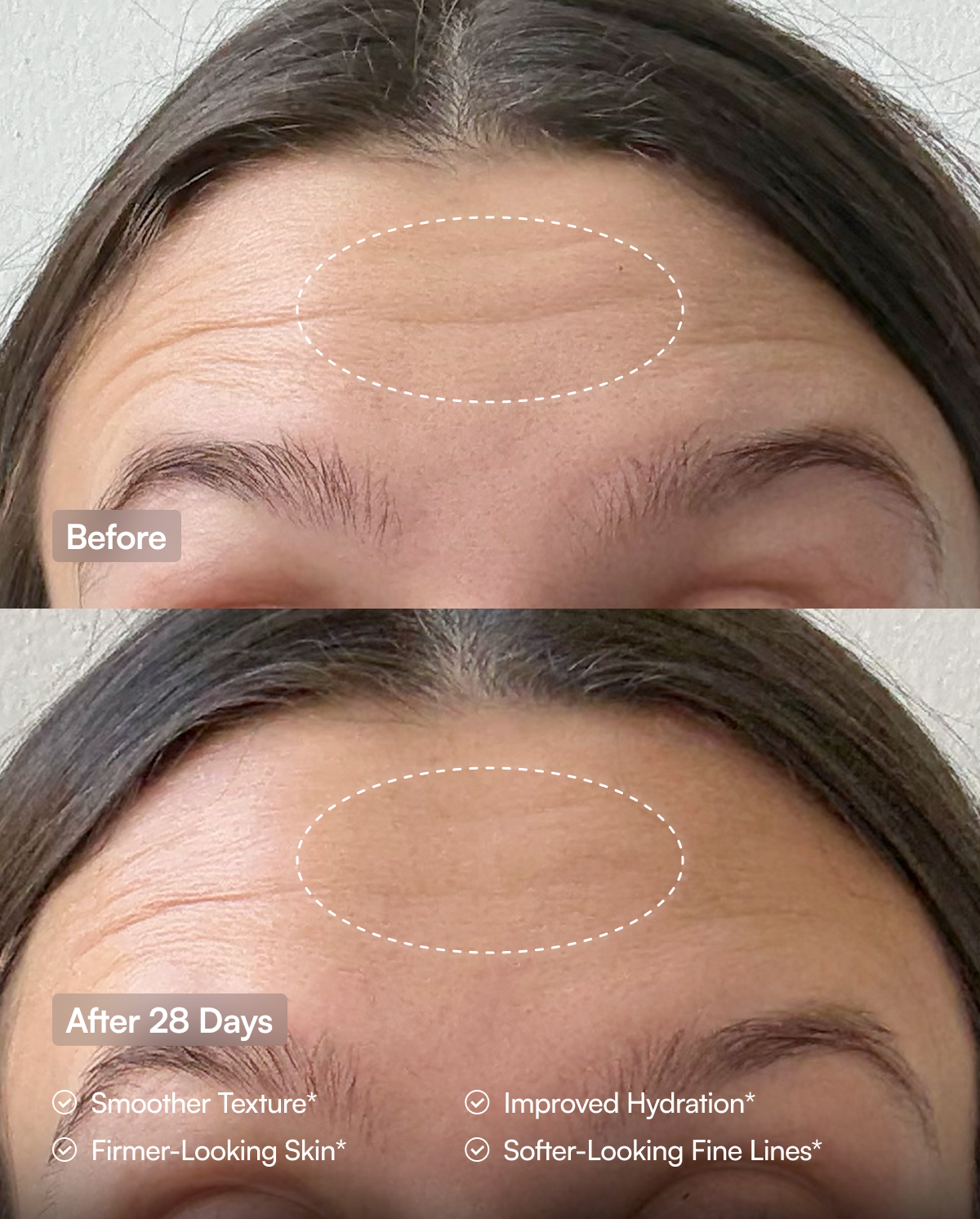 Before-and-after comparison of a woman's forehead, with text indicating improvements after 28 days of using Purity Products Derma5D.