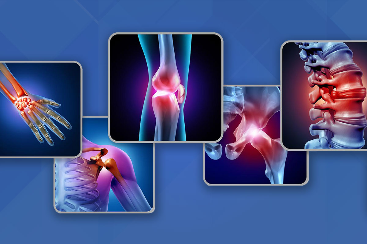 different-joint-types
